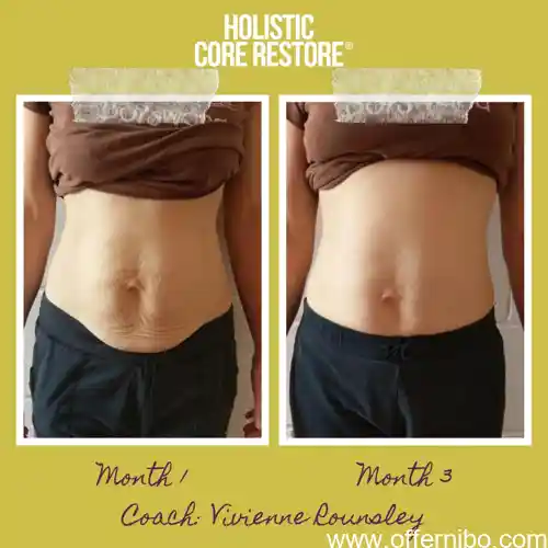 diastasis recti and hernia surgery covered by insurance